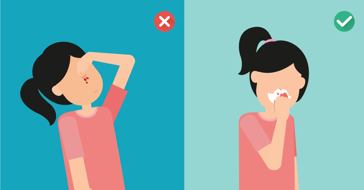 7 Tips Mengatasi Mimisan Ringan Secara Mandiri